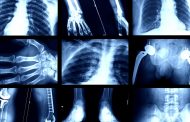 Algorithms Detect Your Race with X-Rays